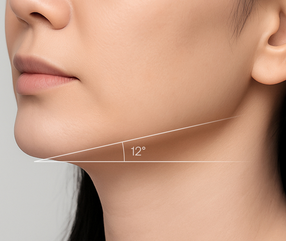 Jmoon 大熨斗美容儀使用 28 天後臉部膚況示意圖,展示肌膚緊緻與下顎線條變化情形