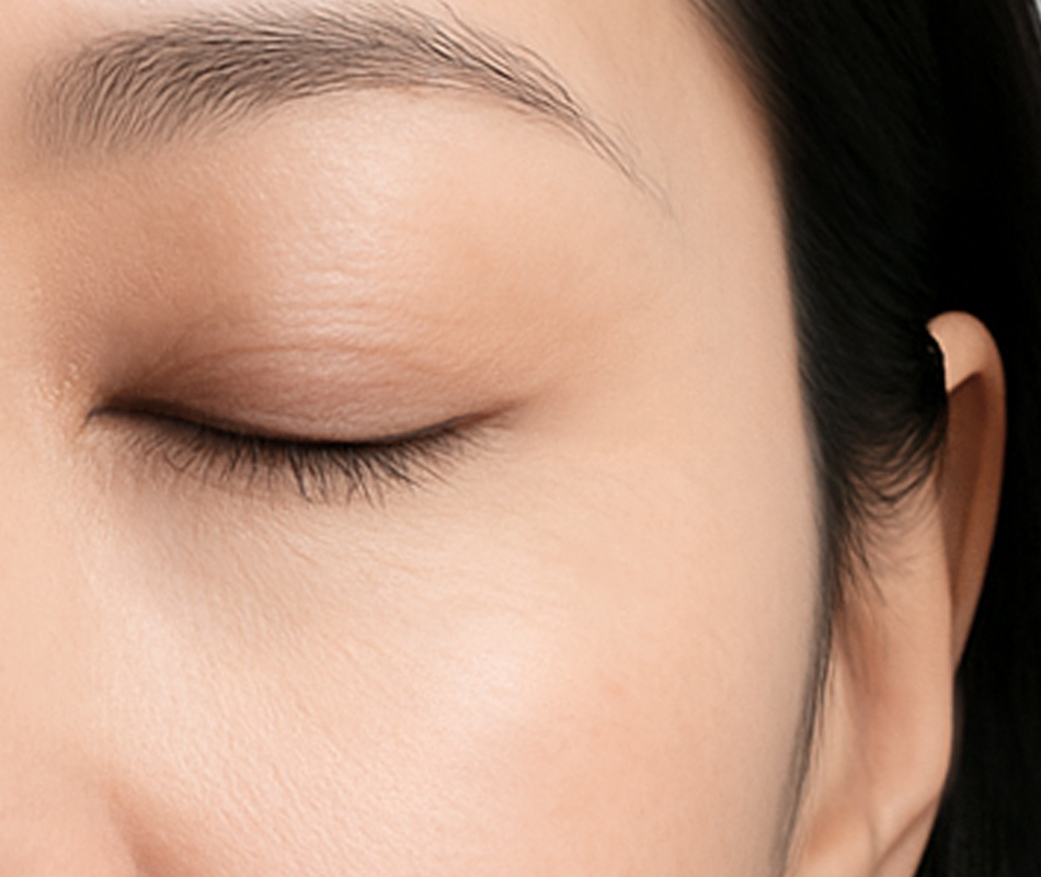 Jmoon 大熨斗美容儀使用後眼周膚況示意圖，展示魚尾紋變化情形